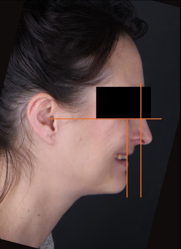 ladyf2